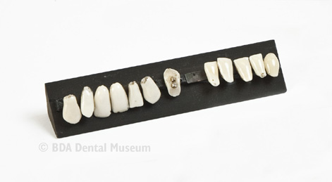 Image of artificial teeth